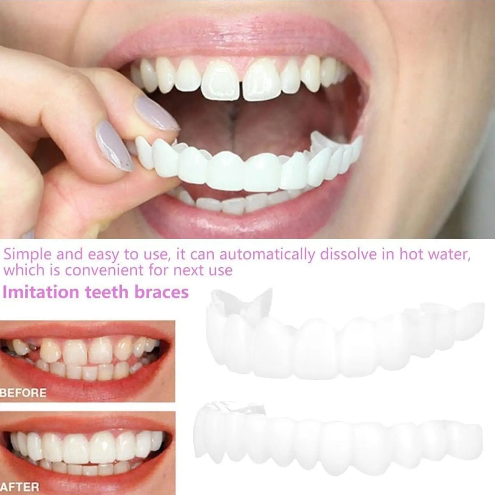 Facettes dentaires clipables pour femme